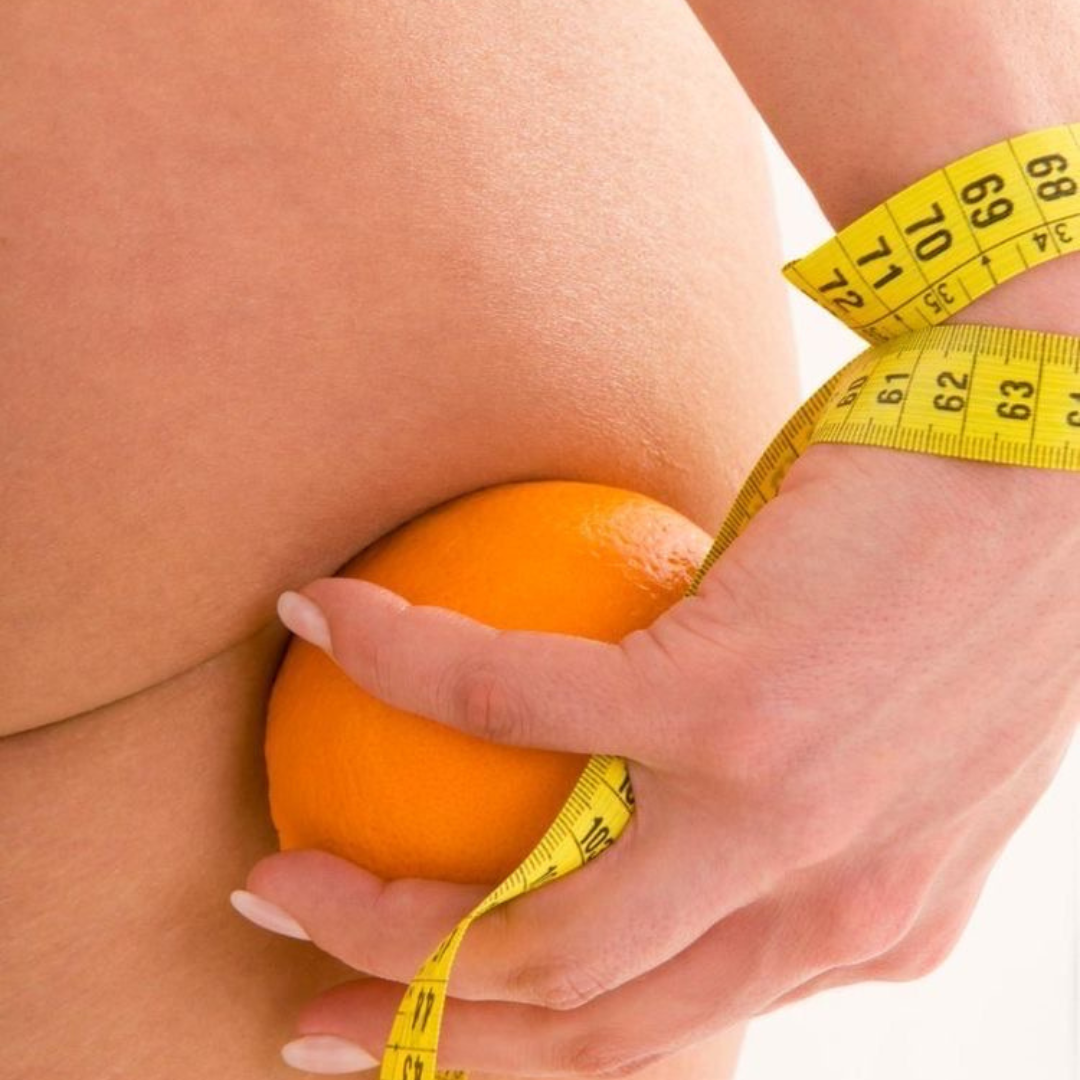 Anti celulitis Kinergia